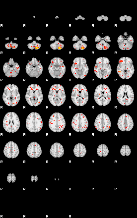 Patient:42;component:115