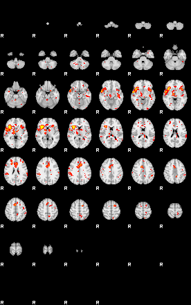 Patient:42;component:151