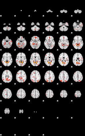 Patient:42;component:161