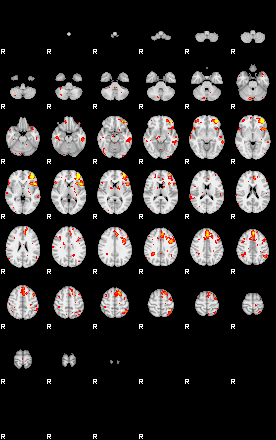 Patient:42;component:193