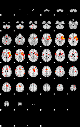 Patient:42;component:195