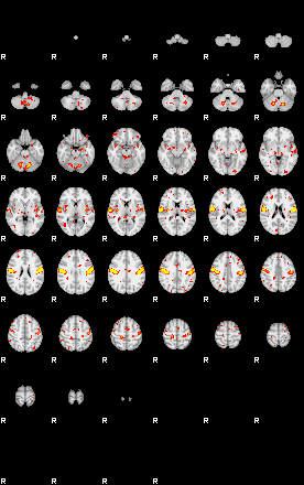 Patient:42;component:199