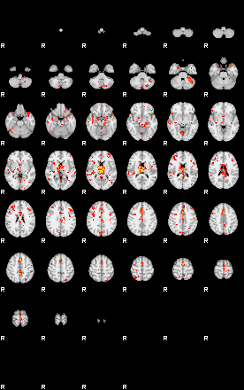 Patient:42;component:47