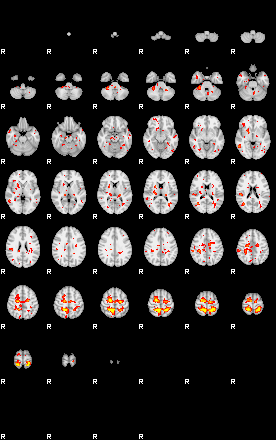 Patient:42;component:55