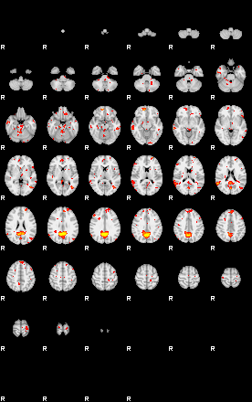 Patient:43;component:100