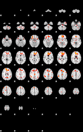 Patient:43;component:105