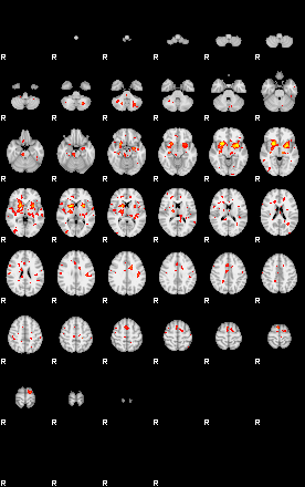 Patient:43;component:108