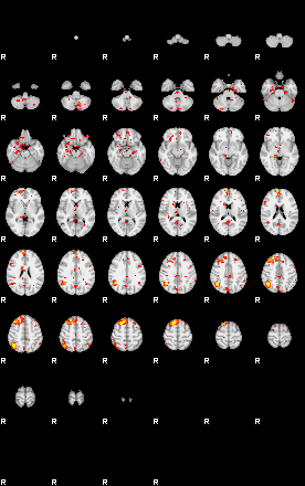 Patient:43;component:110