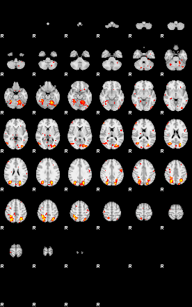 Patient:43;component:122