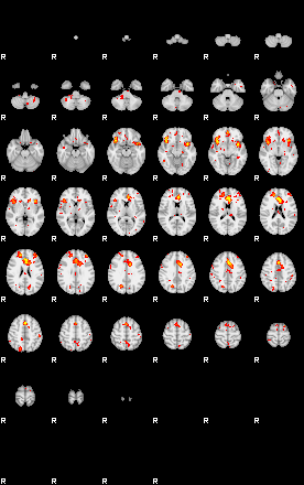 Patient:43;component:125