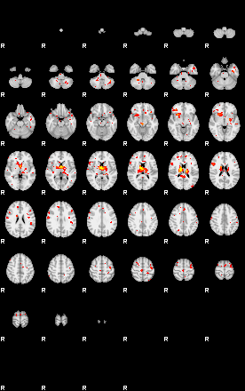 Patient:43;component:129