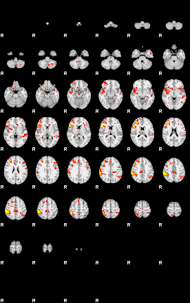 Patient:43;component:138