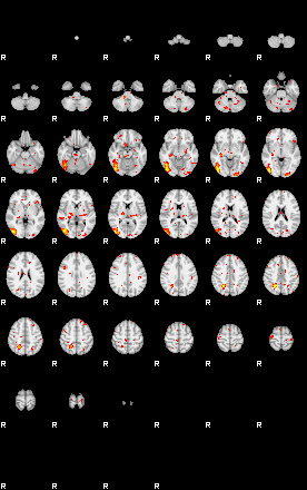 Patient:43;component:143