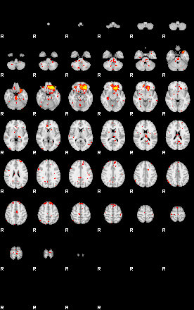 Patient:43;component:144