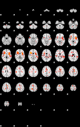 Patient:43;component:151