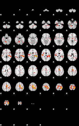 Patient:43;component:158