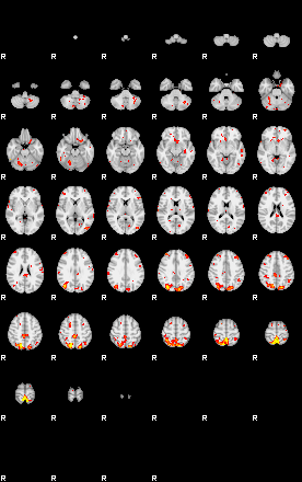 Patient:43;component:166