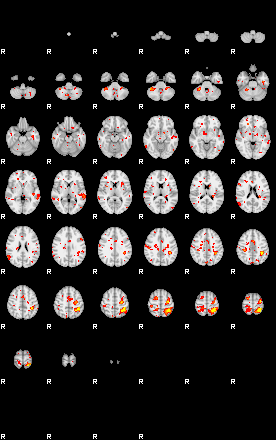 Patient:43;component:176