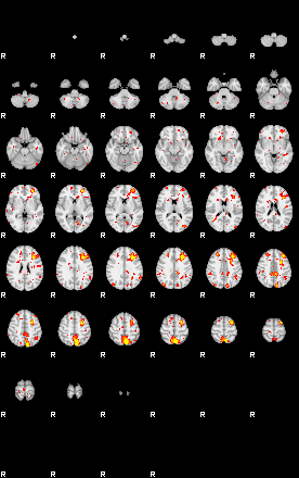 Patient:43;component:193