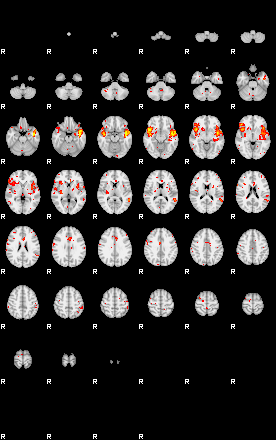 Patient:43;component:195