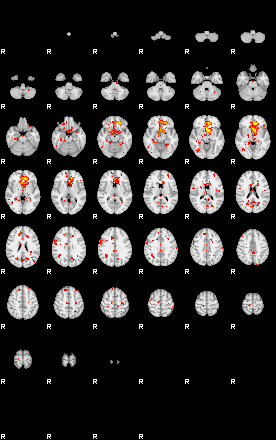 Patient:43;component:27