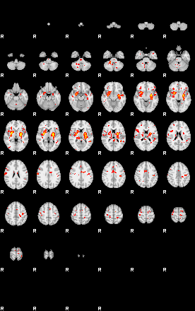 Patient:43;component:39