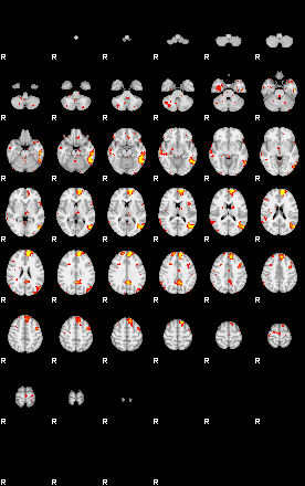 Patient:43;component:44