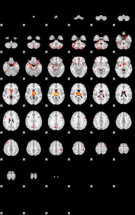 Patient:43;component:47