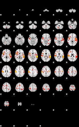 Patient:43;component:56