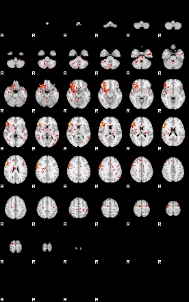 Patient:43;component:6