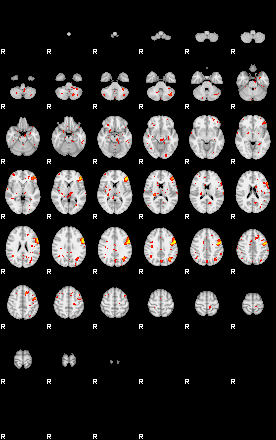 Patient:43;component:60