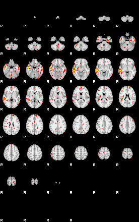 Patient:43;component:98