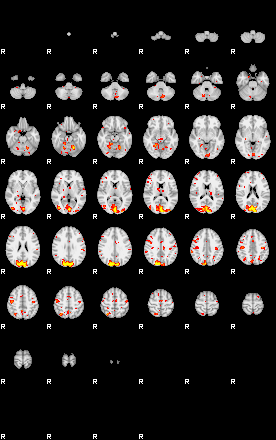 Patient:44;component:102