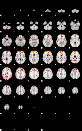 Patient:44;component:105