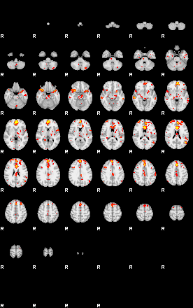 Patient:44;component:116