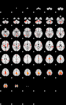 Patient:44;component:12