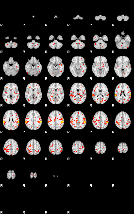 Patient:44;component:150