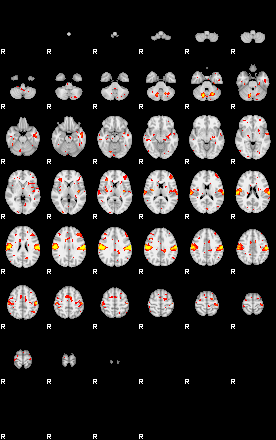 Patient:44;component:154