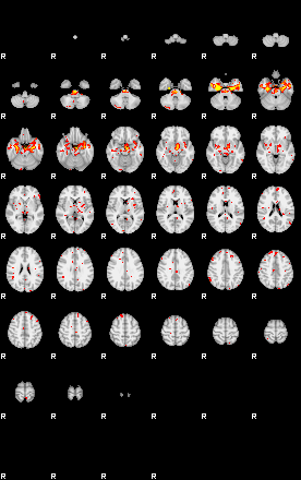 Patient:44;component:160