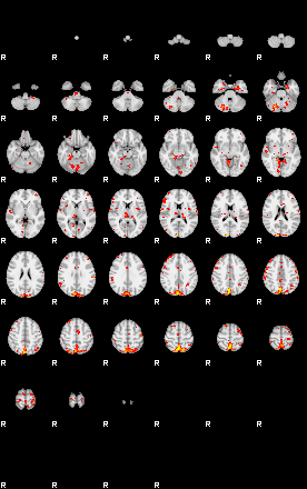 Patient:44;component:166