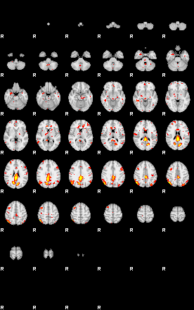 Patient:44;component:180