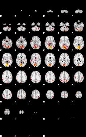 Patient:44;component:30