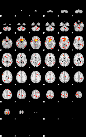 Patient:44;component:43