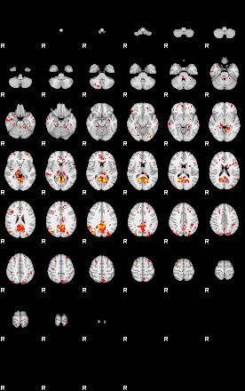 Patient:44;component:5