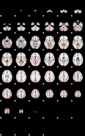 Patient:44;component:51