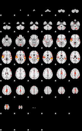 Patient:44;component:56