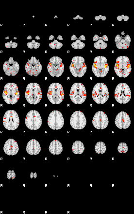 Patient:44;component:58