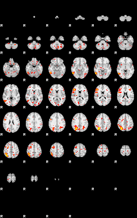 Patient:44;component:6