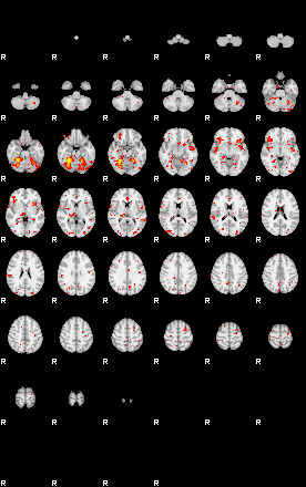 Patient:44;component:82