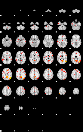 Patient:44;component:93